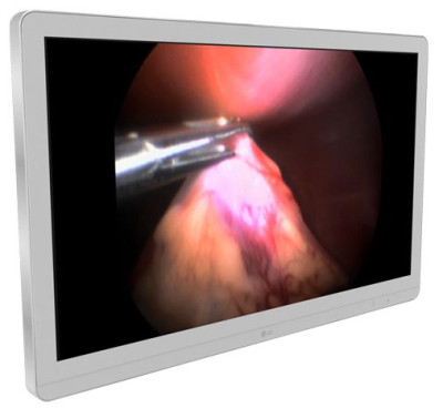 LG 27HK510S-W Digital Signage Display